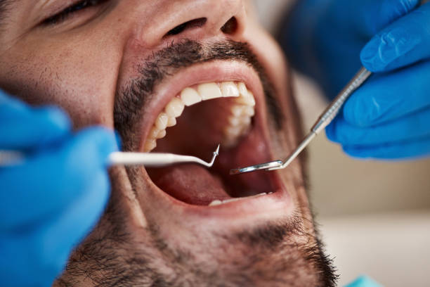 Best Urgent Tooth Repair  in Gap, PA